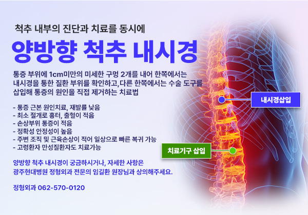 ����� ô�� ���ð�