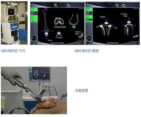 ³»ºñ°ÔÀÌ¼Ç ±â±â¿Í ȸé, ¼ö¼úÀå¸é »çÁø