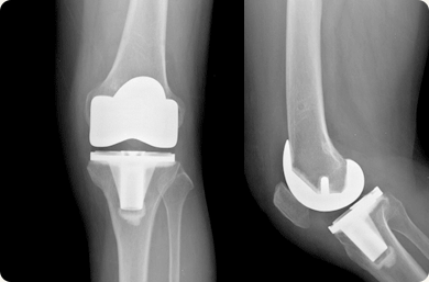 Àΰø°üÀý ¿¢½º·¹ÀÌ »çÁø