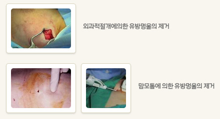 ������ �����̹����� �ܰ��������� ���� ���� �̹���