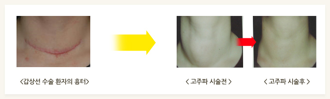 ������ �ü� ���� �̹���. 