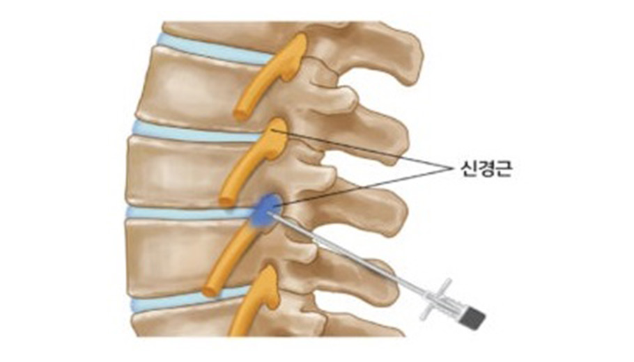 �Ű����ܼ�