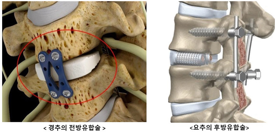 7. ô��ü ���ռ�