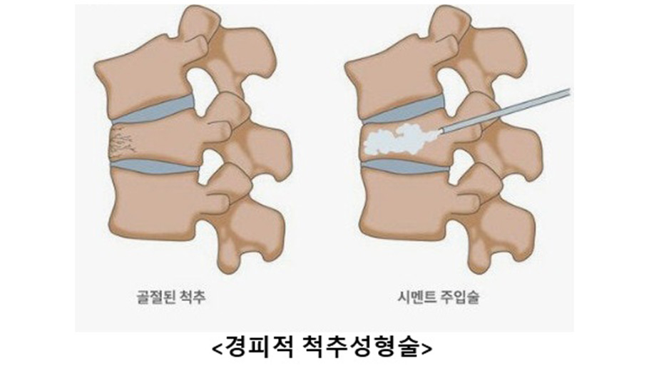 ������ ô�� ������